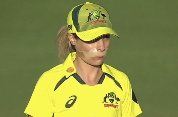 Sophie Molineux injured herself with a sharp throw during 3rd ODI. PC: Twitter