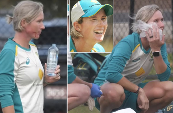 Australia flyhalf Beth Mooney was left with a broken jaw after being hit by a ball in the net ahead of the Women's Ashes series against England.  PC: Cricket Australia / YouTube
